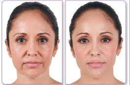 before after plastic surgery 4 e1610632095419