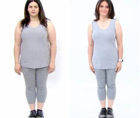 before after weight loss surgery 4