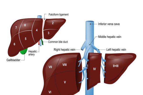 liver transplantation in iran