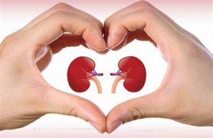 living kidney transplantation in iran