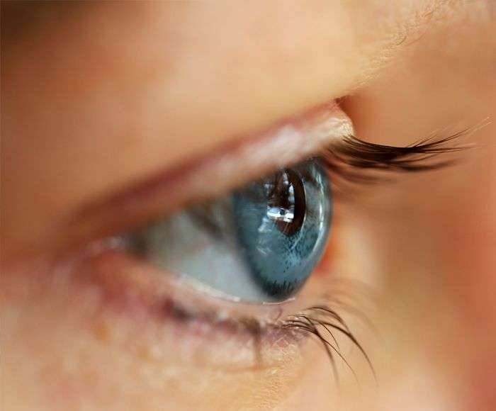 Eye Color Change Artificial Iris Implant Surgery in iran