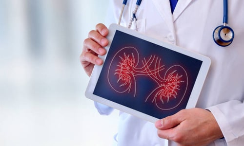Kidney Transplant Surgery 1
