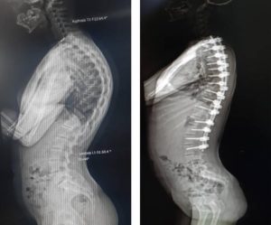 Top Iran Spine Surgeons Sample