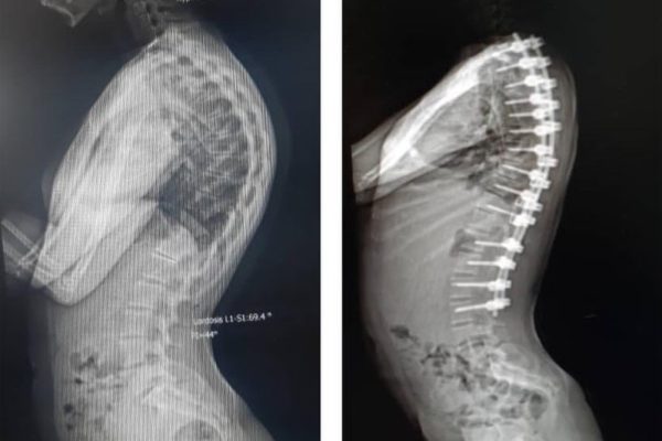 Top Iran Spine Surgeons Sample