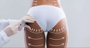 Brazilian Butt Lift 1