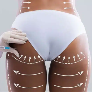 Brazilian Butt Lift 1