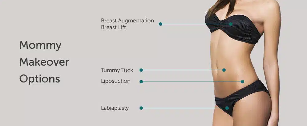 Post Pregnancy Plastic Surgery in Iran