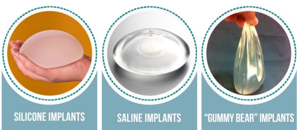 Types of breast implants 2