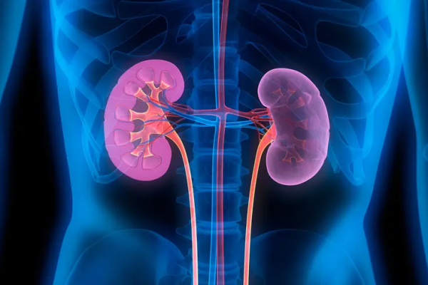 Kidney Disease