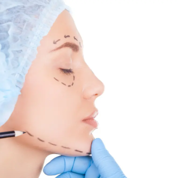 face and jaw surgery in iran