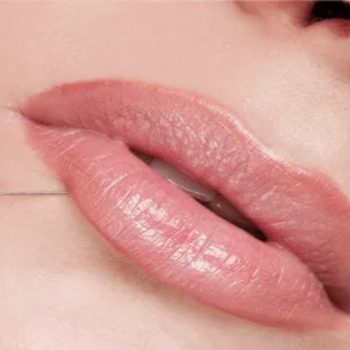lip fillers