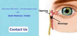 Tear Duct Surgery in Iran