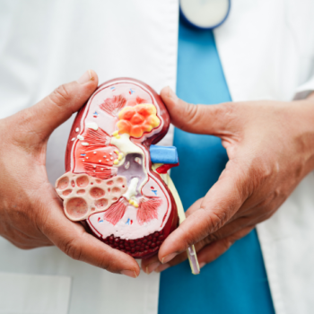 Chronic Kidney Disease CKD Treatment in iran